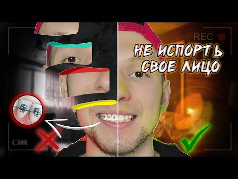 Видео: КАК БРЕКЕТЫ ПОРТЯТ ЛИЦО, То что от вас скрывают ортодонты.