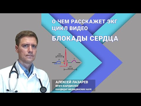 Видео: БЛОКАДЫ СЕРДЦА #блокадыэкг #блокадысердца #экг #ДокторАлексейЛазарев #сердцекардиолог