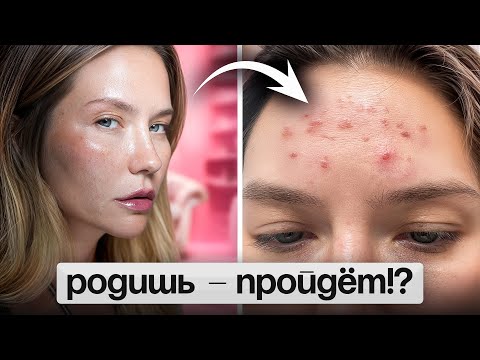 Видео: ТРУДНО БЫТЬ ЖЕНЩИНОЙ: борьба за тело и лицо