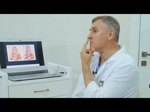 Видео: Пластический хирург: Почему я не делаю себе РИНОПЛАСТИКУ