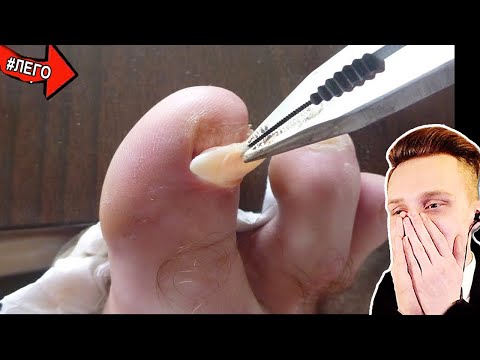 Видео: Попробуй не скажи ОЙ! / РЕАКЦИЯ на САМОЕ НЕ ПРИЯТНОЕ ВИДЕО в МИРЕ