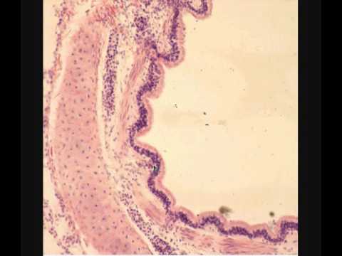 Видео: ЛЕГКОЕ  LUNG  гистологическое строение