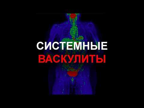 Видео: Системные васкулиты