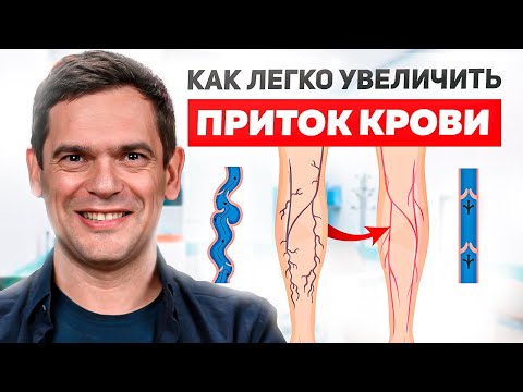 Видео: Боль в Ногах и ПЛОХОЙ ПРИТОК КРОВИ / Как избавиться от тяжести в ногах?