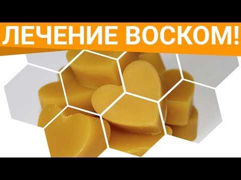 Видео: Лечение пчелиным воском. Рецепт лечения суставов воском. Поговорим про воск пчелиный натуральный!