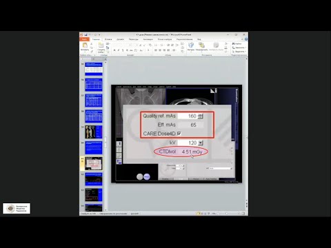 Видео: Два вида согласия пациента на радиологическое исследование