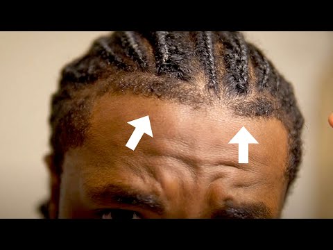 Видео: Как добиться идеальной передней, боковой и задней линии роста волос | Косы, дреды, твисты и афро
