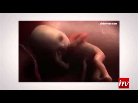 Видео: Гипоксия плода