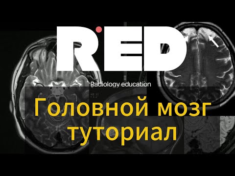 Видео: МРТ головного мозга. Туториал для начинающих