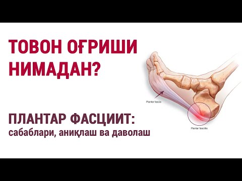 Видео: Товон оғриши нимадан? Плантар фасциит: сабаблари, аниқлаш ва даволаш.