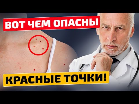 Видео: Никогда бы не подумал, что все так серьезно! Красные точки на коже