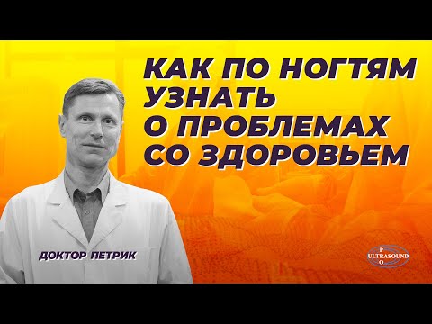 Видео: Как по ногтям узнать о проблемах со здоровьем.