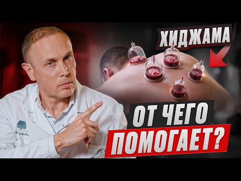 Видео: НЕ ДЕЛАЙ ХИДЖАМУ пока НЕ ПОСМОТРИШЬ ЭТО ВИДЕО!