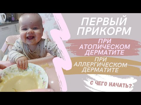 Видео: вводим прикорм | основные правила прикорма | атопический дерматит | аллергический дерматит