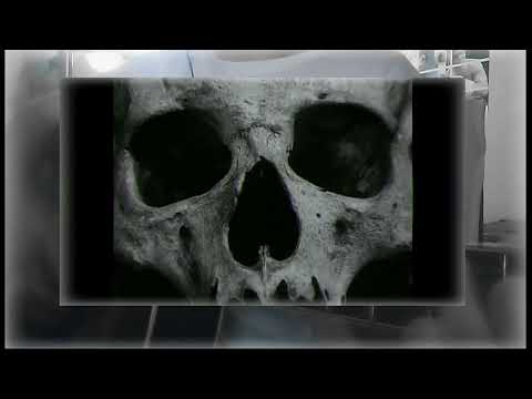 Видео: Порез на Собаке - Наша Эра Началась (cover)