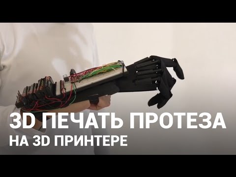Видео: 3D печать протеза руки. Протез на 3D принтере.