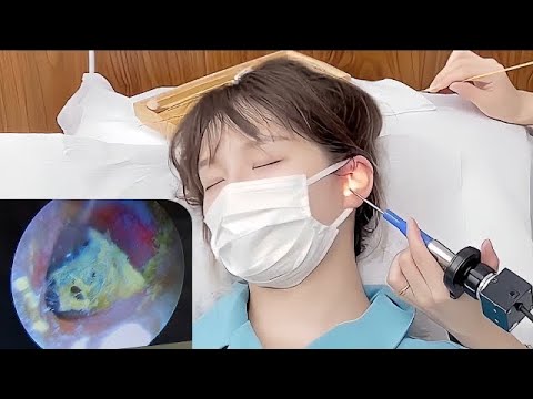 Видео: Китайская красота пришла, чтобы выкопать гигантский уховой воск😍