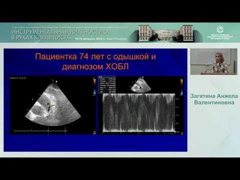 Видео: Ультразвуковое исследование коронарных артерий в клинической практике