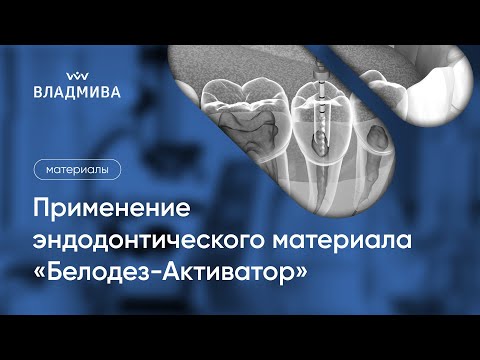 Видео: Применение эндодонтического материала «Белодез-Активатор»