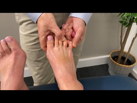 Видео: Как исправить косточку портного (шишку на большом пальце ноги)