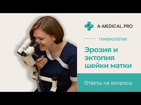 Видео: Что такое эрозия и эктопия шейки матки | Нужно ли лечить эктопию?