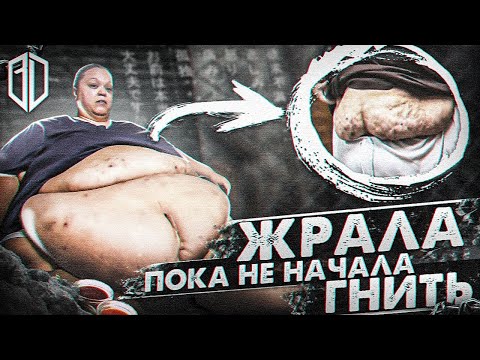 Видео: Живот ВЕСОМ 300 КГ! Что С НЕЙ СТАЛО???