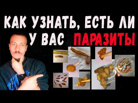 Видео: Как узнать, есть ли у вас кишечные паразиты? Вы будете шокированы тем, что выйдет из вас.
