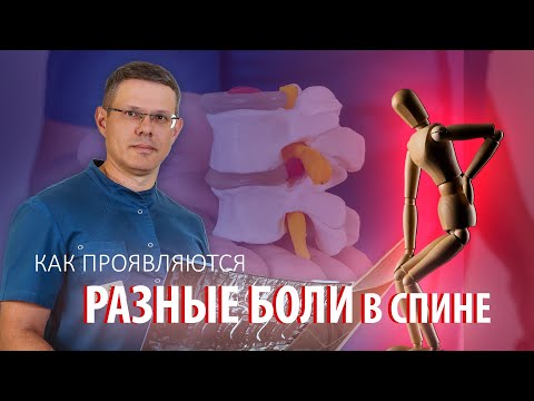 Видео: Как проявляются разные боли в спине?