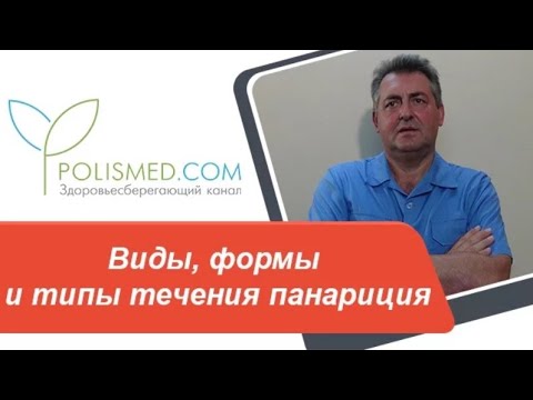 Видео: Виды, формы и типы течения панариция