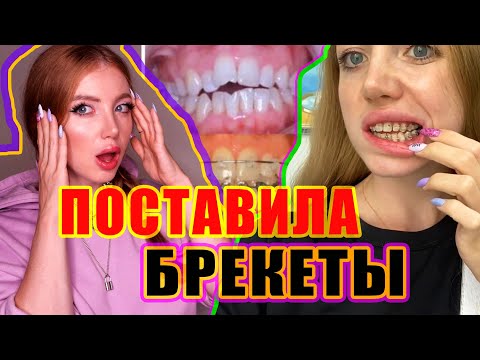 Видео: БРЕКЕТЫ - ЦЕНЫ, МОЙ ПРИКУС, УСТАНОВКА И ОПАСНОСТЬ ПОСЛЕ РИНО.