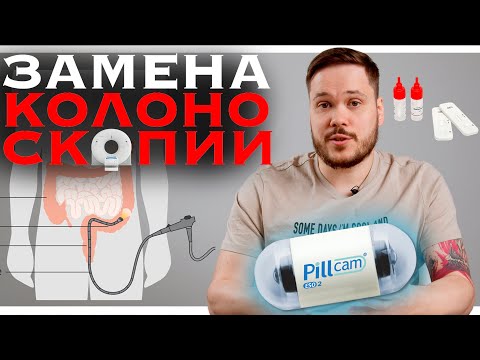 Видео: ЧЕМ ЗАМЕНИТЬ КОЛОНОСКОПИЮ - КАПСУЛЬНАЯ ЭНДОСКОПИЯ, ВИРТУАЛЬНАЯ КОЛОНОСКОПИЯ, СИГМОСКОПИЯ