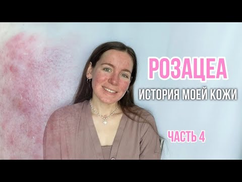 Видео: РОЗАЦЕА. ИСТОРИЯ МОЕЙ КОЖИ. ЧАСТЬ 4: НОВЫЙ ПОДХОД К ЛЕЧЕНИЮ