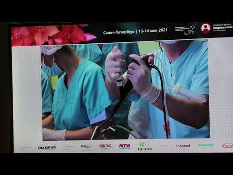 Видео: 48 Live Данилевская ОВ Беков МТ Бронхоскопия трансбронхиальная Криобиопсия легкого EBUS TNBA