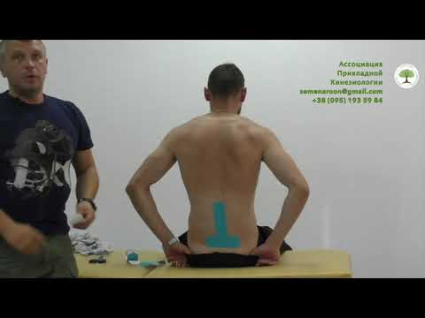 Видео: Тейпирование позвоночника - просто и доступно. Дмитрий Кущик. Прикладная кинезиология.