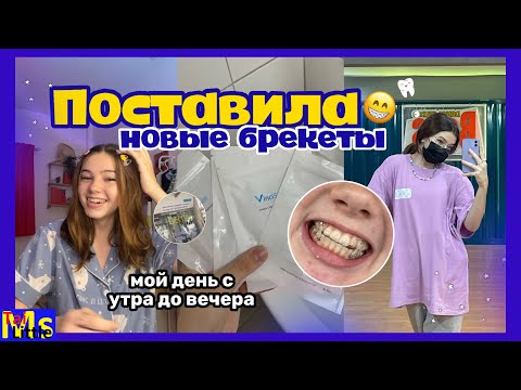 Видео: VLOG Ставлю БРЕКЕТЫ || мои ужасные зубы