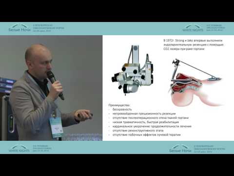 Видео: Эндоларингеальная лазерная резекция при местно-распространенном раке гортани