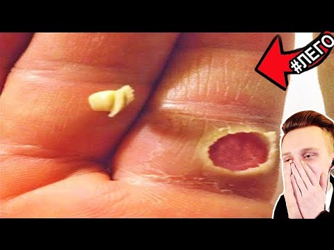 Видео: ВСЯ БОЛЬ В ОДНОМ ВИДЕО.. Попробуй не СКАЗАТЬ ФУ! РЕАКЦИЯ на САМОЕ НЕПРИЯТНОЕ ВИДЕО ТикТок Райли