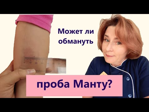 Видео: Когда Манту нам врет