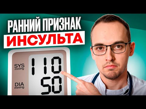 Видео: ТОП-3 ОПАСНЫХ ПРЕДВЕСТНИКА ИНСУЛЬТА. Как спасти сосуды головного мозга?