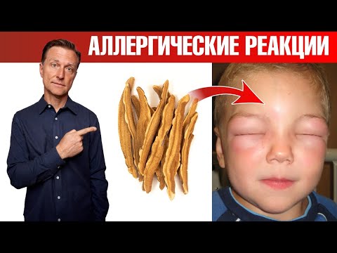 Видео: Натуральные средства при анафилактическом шоке🧐
