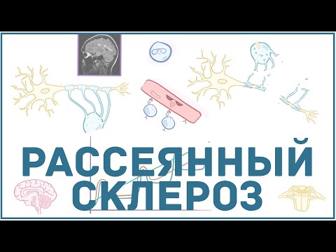 Видео: Рассеянный склероз - причины, симптомы, диагностика, лечение