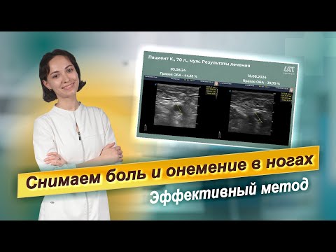 Видео: Снимаем боль и онемение в ногах. Эффективный метод лечения атеросклероза конечностей.