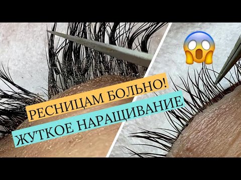 Видео: НАРАЩИВАНИЕ РЕСНИЦ С ОШИБКАМИ. ПЕРЕДЕЛЫВАЕМ ЖУТЬ!