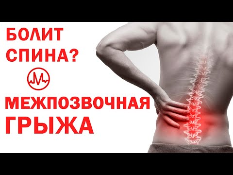Видео: ГРЫЖА МЕЗПОЗВОНОЧНОГО ДИСКА - диагноз. Мифы о грыже в спине. О самом главном - здоровье Жить здорово