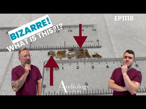 Видео: Странное открытие ушной серы! Что это такое! 😱👂 EP1118