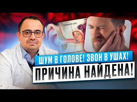 Видео: Шум в голове, звон и шум в ушах. Причина в этом!