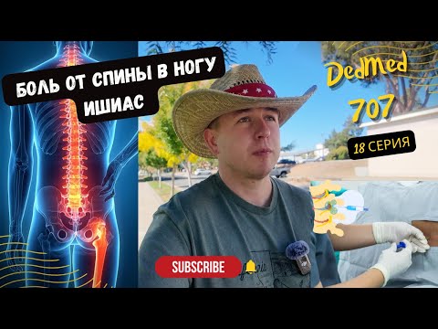 Видео: Ишиас. Боль в седалищном нерве и мой опыт с эпидуральной инъекцией 