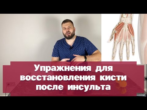 Видео: Комплекс упражнений для кисти и пальцев после инсульта