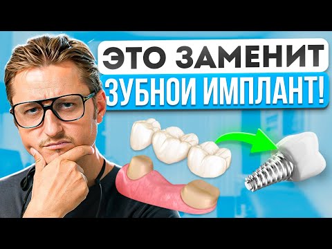 Видео: Можно ли заменить ЗУБНОЙ ИМПЛАНТ? Альтернатива имплантации зубов в 2025!