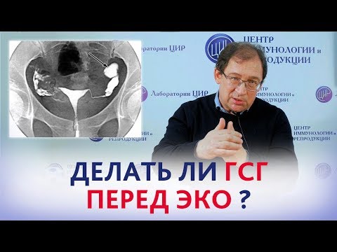 Видео: ГСГ (ГИСТЕРОСАЛЬПИНГОГРАФИЯ). Зачем нужна ГСГ? Отвечает доктор Гузов.
